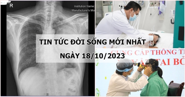 Tin tức đời sống mới nhất ngày 18/10: Mất một bên phổi vì thói quen thường thấy ở nhiều nam giới