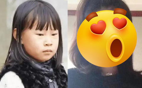 Bị miệt thị ngoại hình vì giống bố, bé gái nói 1 câu khiến phụ huynh xúc động, nhan sắc 7 năm sau gây bất ngờ