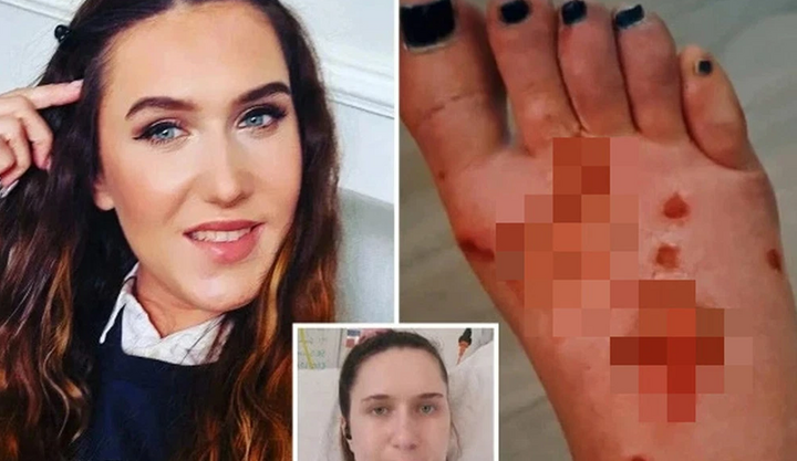 Sơ suất trong lúc tự làm móng tại nhà, cô gái trẻ phải nhận kết cục kinh hoàng