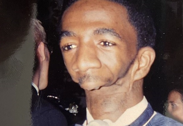 Người đàn ông bẩm sinh không có hàm: Bị cha mẹ ruồng bỏ, hạnh phúc bên người vợ xinh đẹp