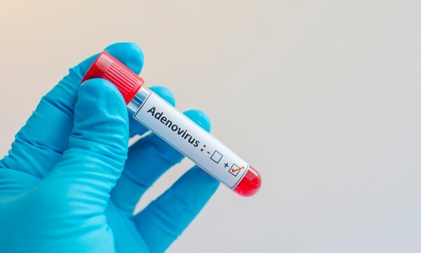 Adenovirus là gì? Sự nguy hiểm của Adenovirus