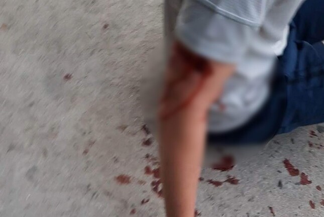 Xác minh vụ du khách nước ngoài bị chó cắn nhập viện tại Nha Trang