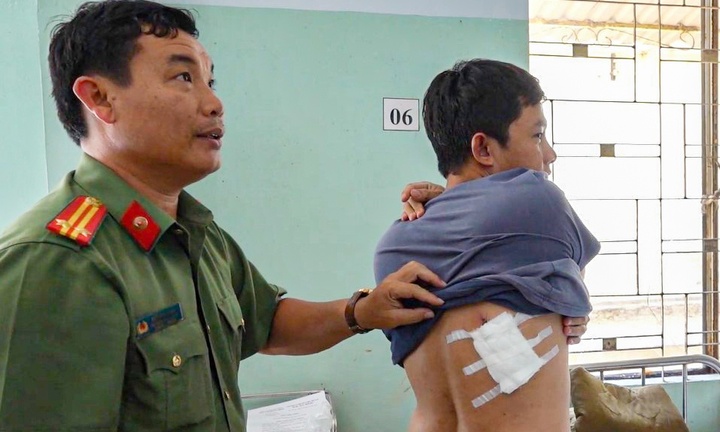 Nghi phạm buôn bán ma túy dùng dao tấn công 2 cảnh sát