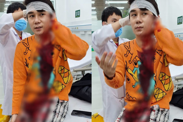 Khởi tố vụ diễn viên phim “Thương ngày nắng về” bị chém trên phố Hà Nội