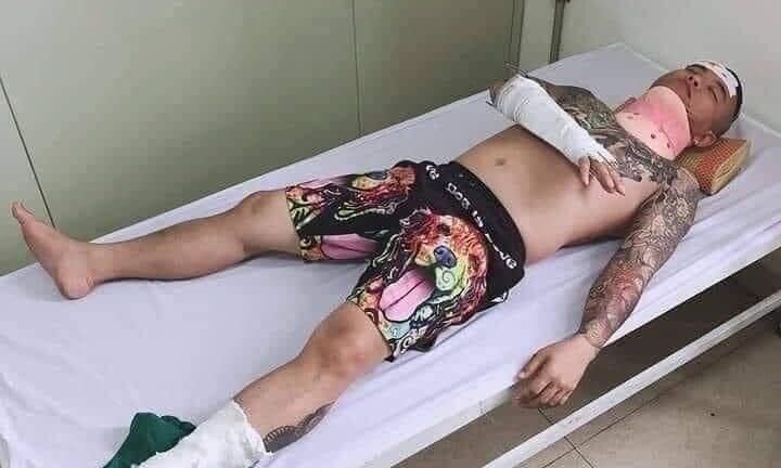 Thực hư thông tin “thánh chửi” Dương Minh Tuyền bị đâm nguy kịch