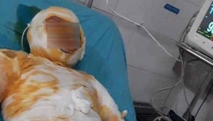 Vụ nghi án chồng tẩm xăng đốt vợ ở Đồng Nai: Hé lộ nguyên nhân