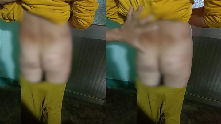 Đánh con riêng của chồng, người phụ nữ bị xử phạt 15 triệu đồng