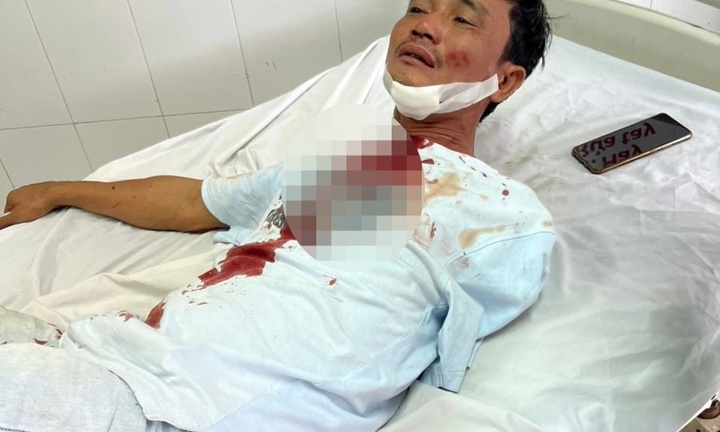 Vụ người khuyết tật bị vợ chồng tài xế xe tải đánh nhập viện: Hé lộ nguyên nhân