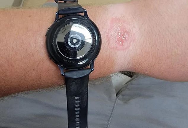 Tin tức công nghệ mới nóng nhất hôm nay 22/9: Bỏng tay vì đeo Samsung Galaxy Watch qua đêm