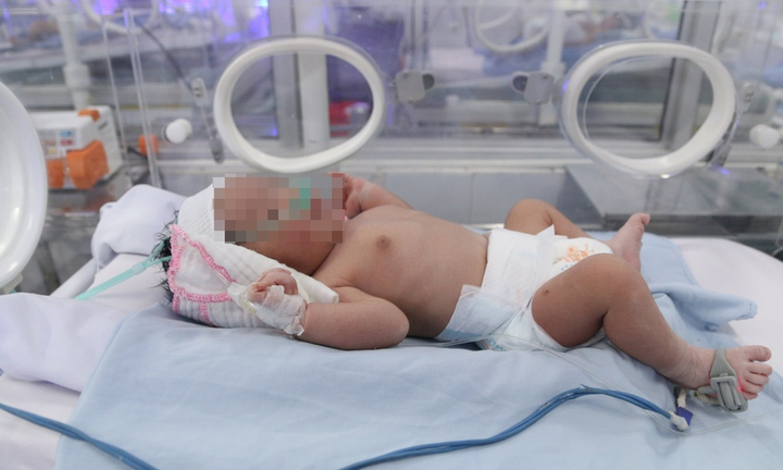 Bé trai sơ sinh mắc dị tật bẩm sinh bị bỏ rơi gần nghĩa trang giữa đêm giá rét