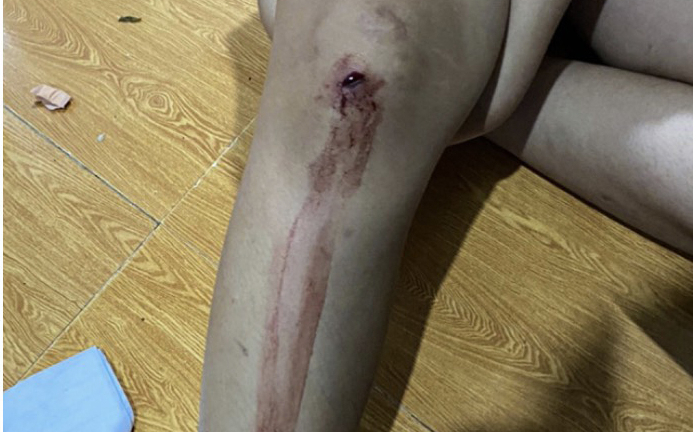 Vụ gã đàn ông nổ súng khiến 2 chị em trúng đạn: Công an trích xuất camera