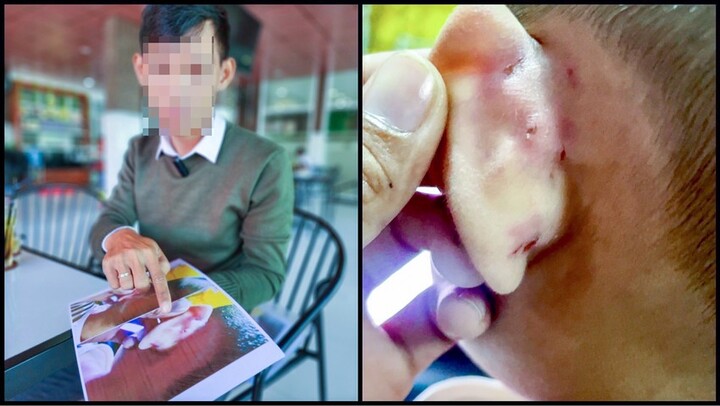 Tình tiết mới vụ cô giáo mầm non bạo hành bé trai 4 tuổi ở Kiên Giang