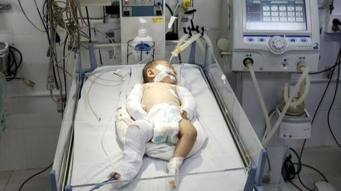 Sức khỏe của cháu bé hơn 2 tháng tuổi bị bạo hành dã man ở Đà Lạt giờ ra sao?