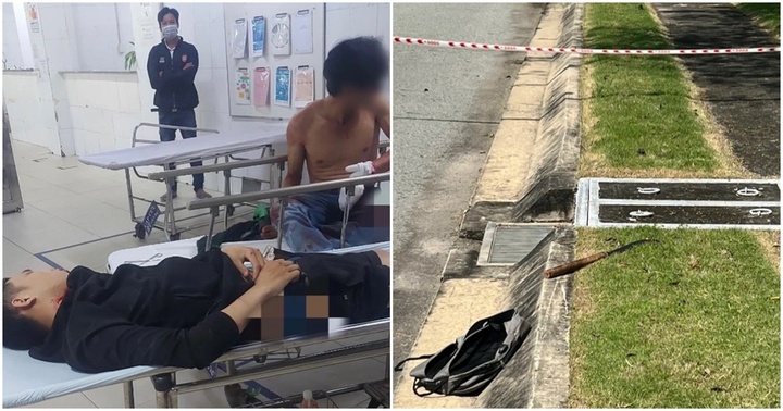 Vụ chém tài xế xe ôm công nghệ, cướp xe máy ở Bình Dương: Công an thông tin chính thức