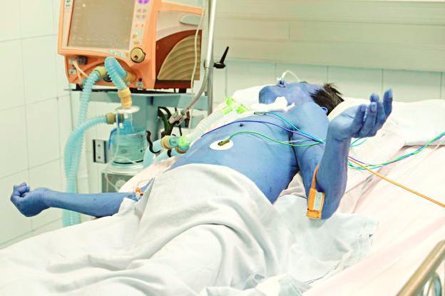 Nguy kịch tính mạng vì vết thương nhỏ ở bàn chân