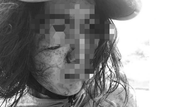 Vụ cô gái 22 tuổi bị rạch mặt lúc đi photo giấy tờ ly hôn: Lộ diện nghi phạm bất ngờ