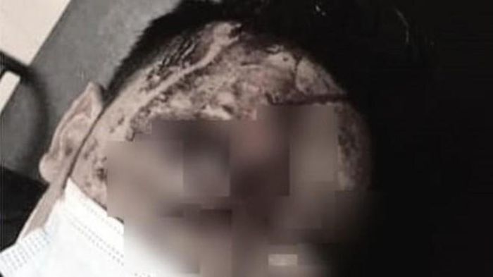 Vụ giữa đêm đang ngủ bị đánh đến nhập viện ở Thái Bình: Bất ngờ nghi phạm