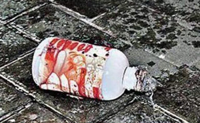 Vụ 7 người bị tạt axit ở Quảng Ninh: Chính quyền tiết lộ bất ngờ