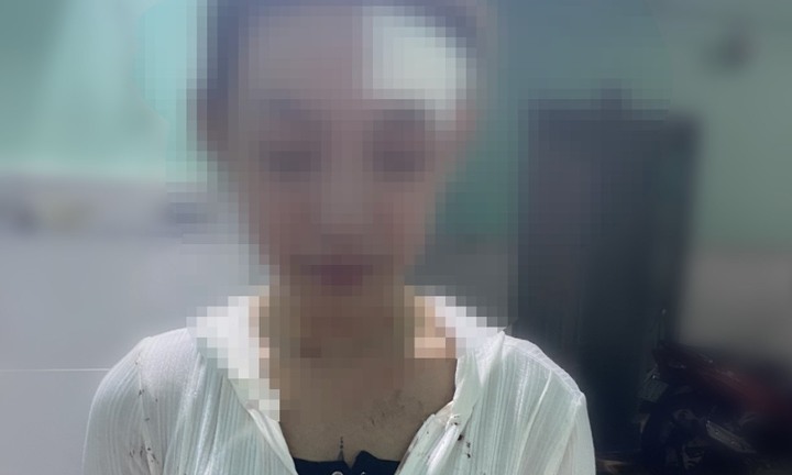 Vụ clip nữ công nhân 19 tuổi bị đánh hội đồng dã man: Diễn biến mới nhất