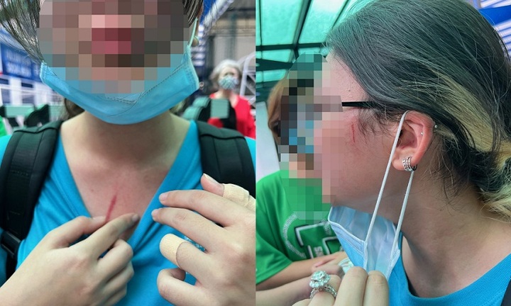 Vụ học sinh trường quốc tế ở TP.HCM bị đánh: Hiệu trưởng trường xác nhận sự việc