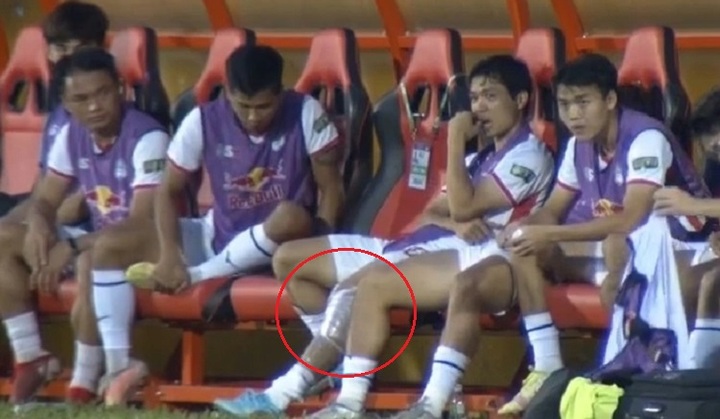 Công Phượng chấn thương đầu gối, phải nghỉ 1 tháng