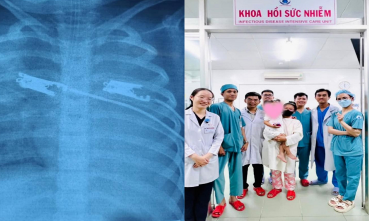 Bé gái tổn thương gan, thận nguy kịch vì sốt mò