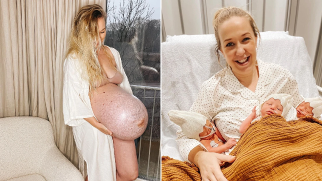 Cư dân mạng choáng váng chiếc bụng bầu “dị thường” của người phụ nữ sinh 3