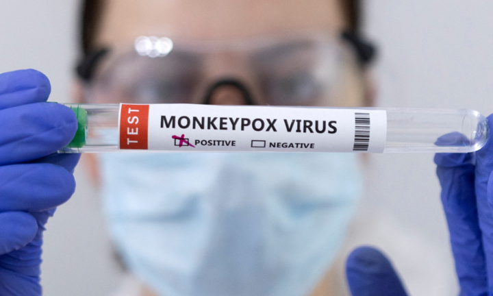 New York đề nghị WHO đổi tên bệnh đậu mùa khỉ để tránh 'kỳ thị'