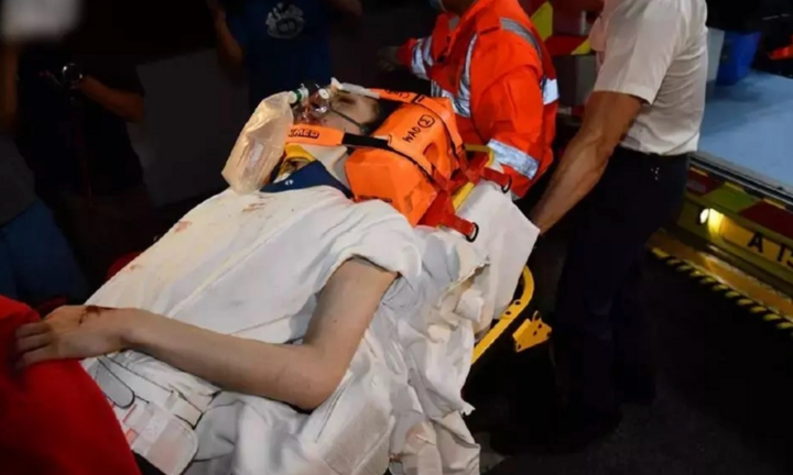 Tình hình sức khoẻ nam vũ công bị màn hình LED 600 kg rơi trúng người