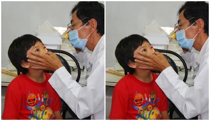 Sở Y tế TP.HCM: Đã xác định được tác nhân gây bệnh đau mắt đỏ