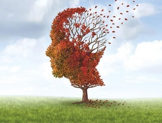 Dùng ngay sản phẩm thảo dược Kinh Vương Não Bộ nếu bị di chứng mất trí nhớ sau tai nạn