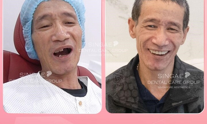 Nha khoa Singae dental - Hệ thống chăm sóc răng uy tín tại Việt Nam 