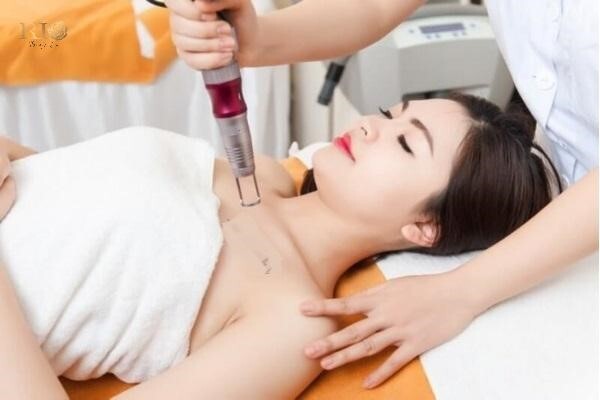 Thẩm mỹ Rio – địa chỉ xóa xăm uy tín tại Hà Nội