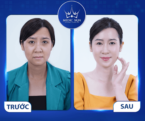 Người mẹ đơn thân và hành trình tìm lại cuộc đời