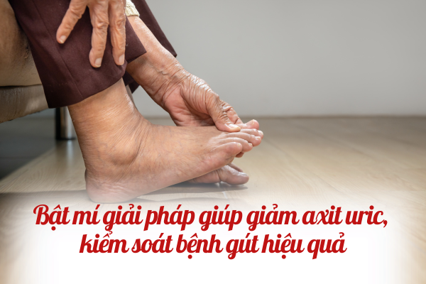 Bật mí giải pháp giúp giảm axit uric, kiểm soát bệnh gút hiệu quả