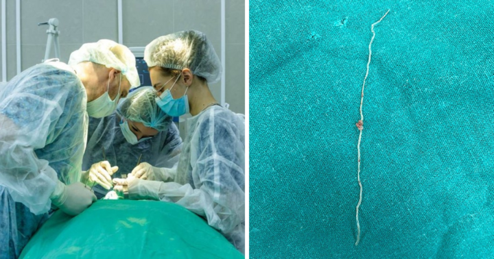 Ký sinh trùng dài 15cm trong mắt người đàn ông sau khi bị muỗi đốt