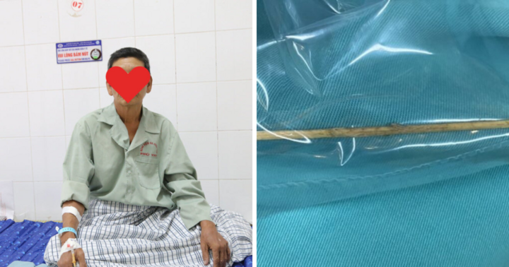 Người đàn ông thủng đại tràng vì thói quen nhiều người Việt mắc phải