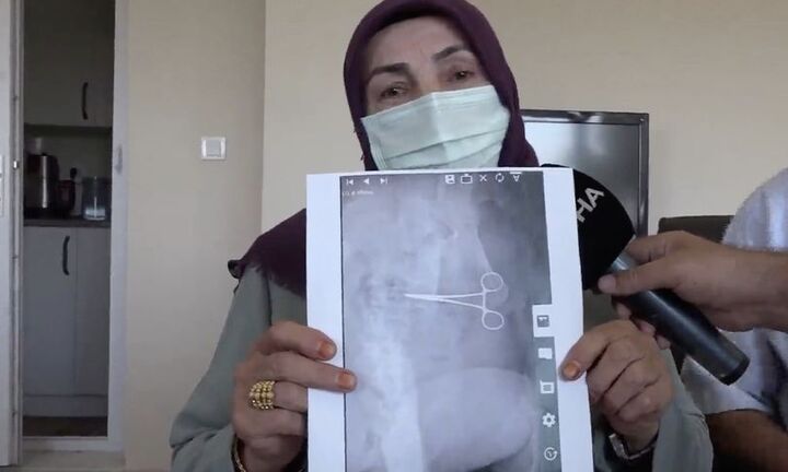 Đau đớn quằn quại sau ca phẫu thuật, người phụ nữ phát hoảng khi xem kết quả chụp X-quang