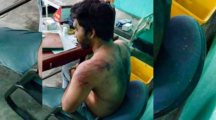 Nam bác sĩ bị người nhà bệnh nhân tử vong do COVID-19 đánh hội đồng