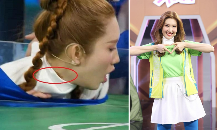 Bị thương nghiêm trọng ở cổ, Thúy Ngân tạm dừng công việc để điều trị vết thương