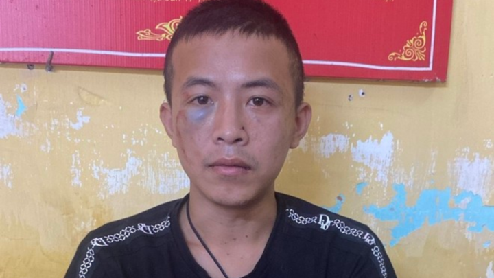 Vụ chém 3 người trọng thương ở Hà Nội: Nghi phạm có bệnh án tâm thần