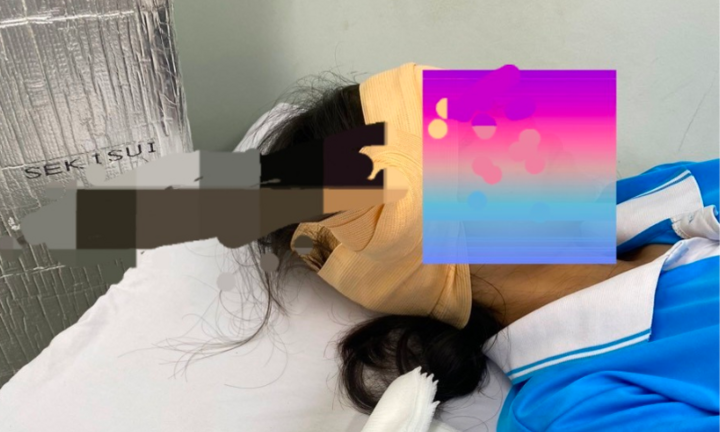 Đang uống nước trong sân trường, một nữ sinh ở Kiên Giang bị lưỡi dao găm trúng đầu