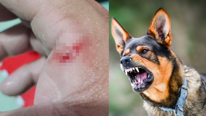 Chó cắn nhưng không chích ngừa, người đàn ông biểu hiện nghi bệnh dại, cắn vợ chảy máu