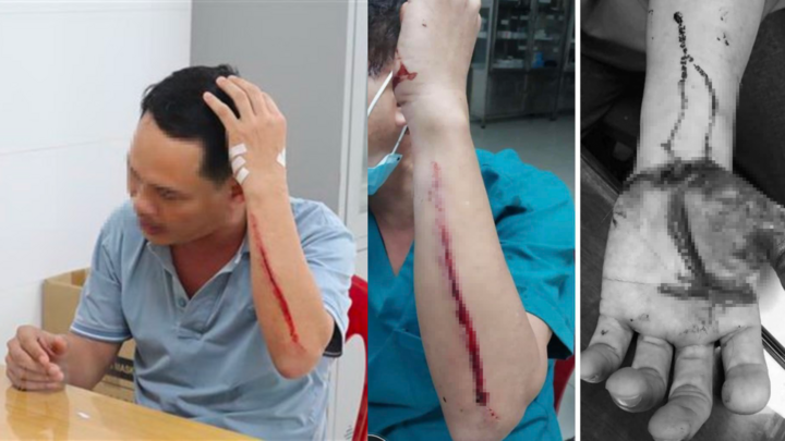 Điều tra vụ nam điều dưỡng bị người nhà bệnh nhân 