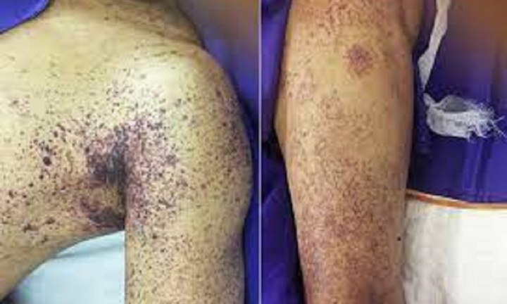 Bắc Giang: Người đàn ông hôn mê, nguy kịch sau 2 ngày mổ lợn