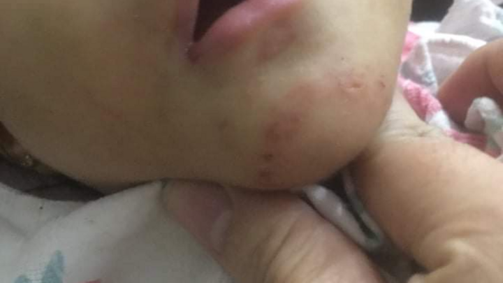 Vụ bé 16 tháng tuổi bị bầm tím ở Hải Phòng: Bé gái chưa có tên khai sinh