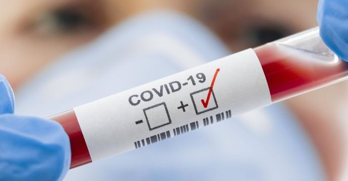 Tin tức thời sự mới nóng nhất 21/11: Côn Đảo ghi nhận ca nhiễm COVID-19 đầu tiên