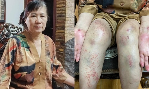 Người phụ nữ sống sót sau 7 ngày rơi xuống vực: Không bịa chuyện để 