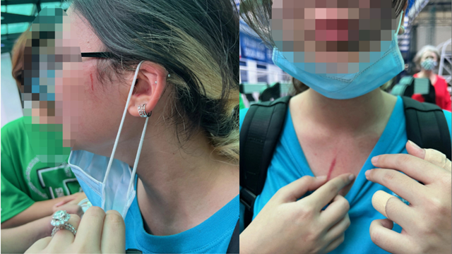 TP.HCM: Phụ huynh tố con bị đánh, trường quốc tế phản hồi gì? 