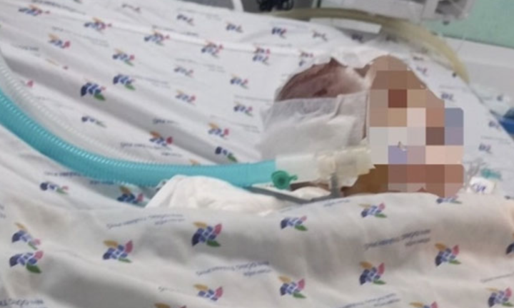 Hội Bảo vệ quyền trẻ em vào cuộc vụ bé 6 tháng tuổi bị bạo hành dập não